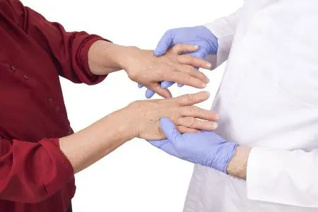 Как лечить воспаление суставов рук